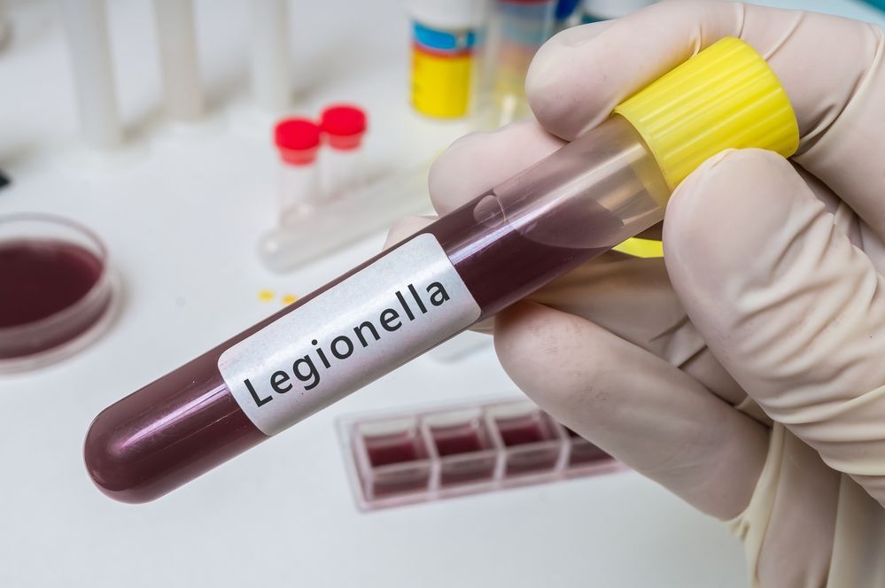 Λεγιονέλλα - Νόσος Λεγεωνάριων - Μελέτη υγειονομικής αναγνώρισης - επικινδυνότητας